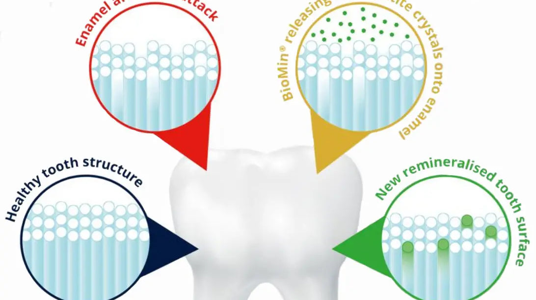 Calcium-Natrium-Fluorophosphosilicat-remineralisiert-den-Zahnschmelz-effektiver-als-herkömmliche-Fluoridzahnpasta Snow Pearl GmbH