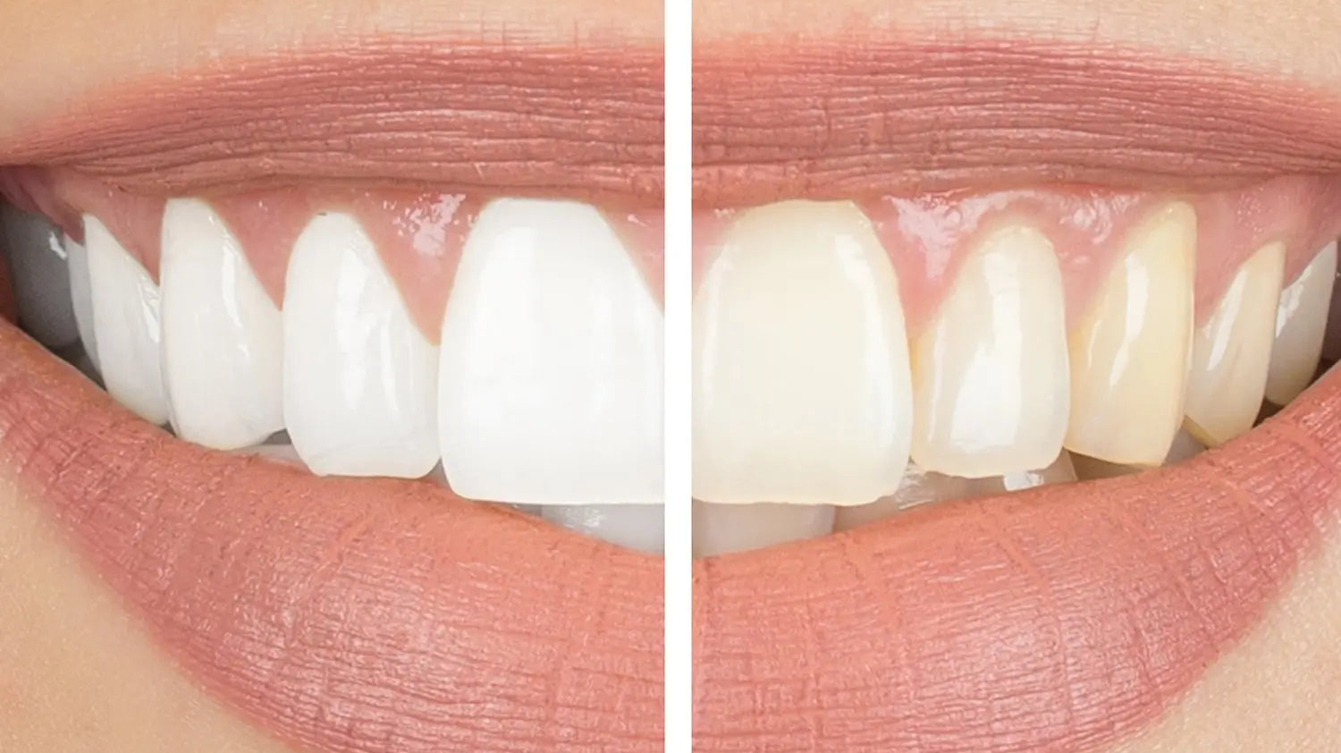 Welches-Bleichmittel-sollte-ich-wählen-um-meine-Zähne-aufzuhellen Snow Pearl GmbH
