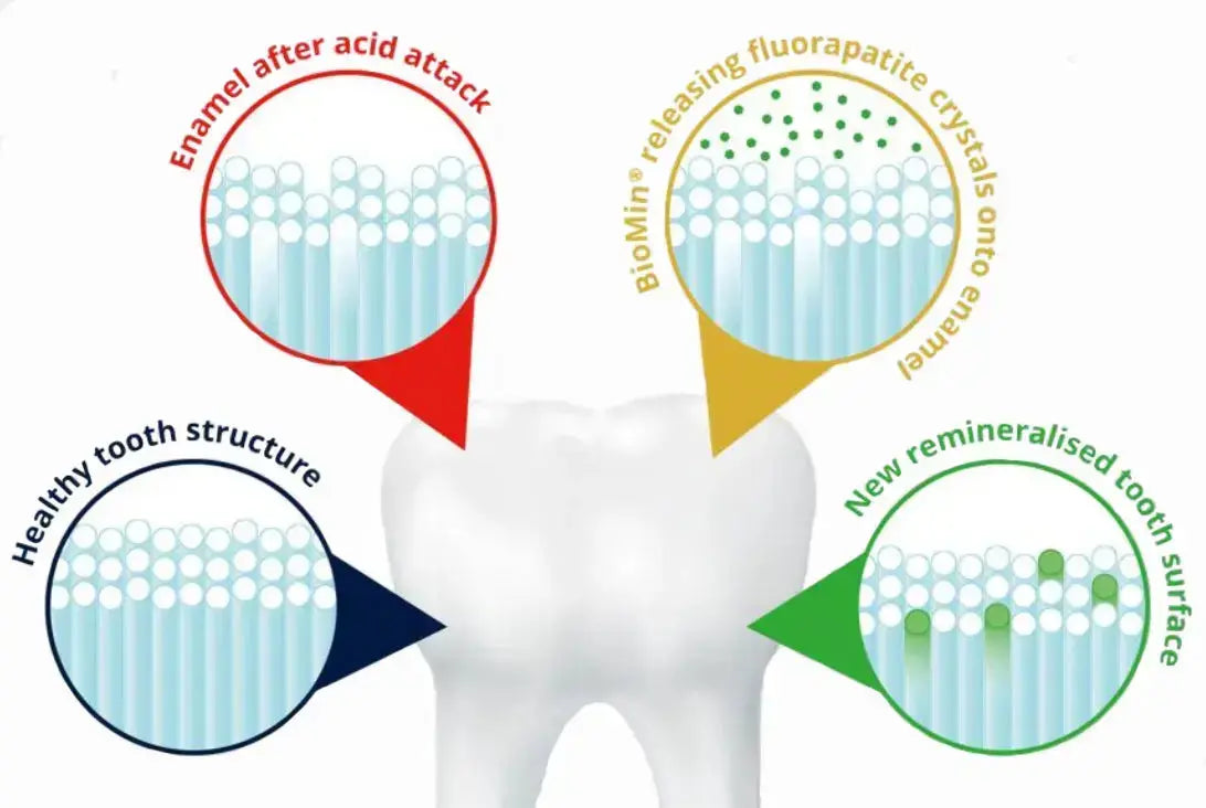 Calcium-Natrium-Fluorophosphosilicat-remineralisiert-den-Zahnschmelz-effektiver-als-herkömmliche-Fluoridzahnpasta Snow Pearl GmbH