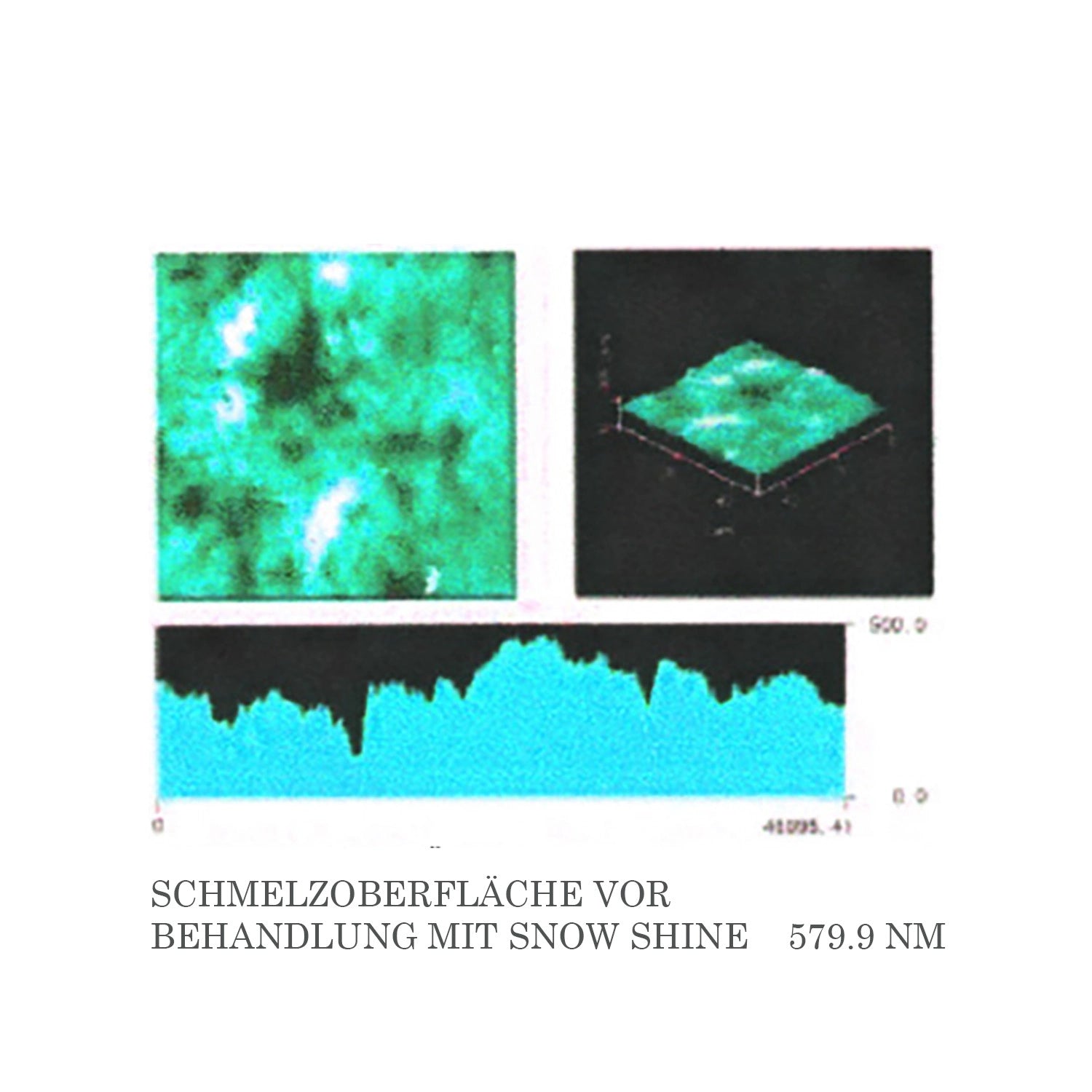 Schmelz Oberfläche vor der Behandlung mit Snow Shine Whitening Foam